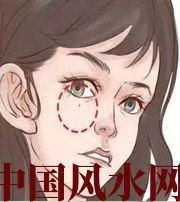 宜宾脸上这些地方有痣，不利财运，一生难发大财